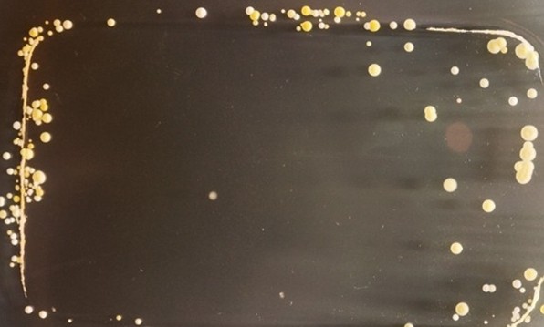 显微镜下面看到的手机细菌