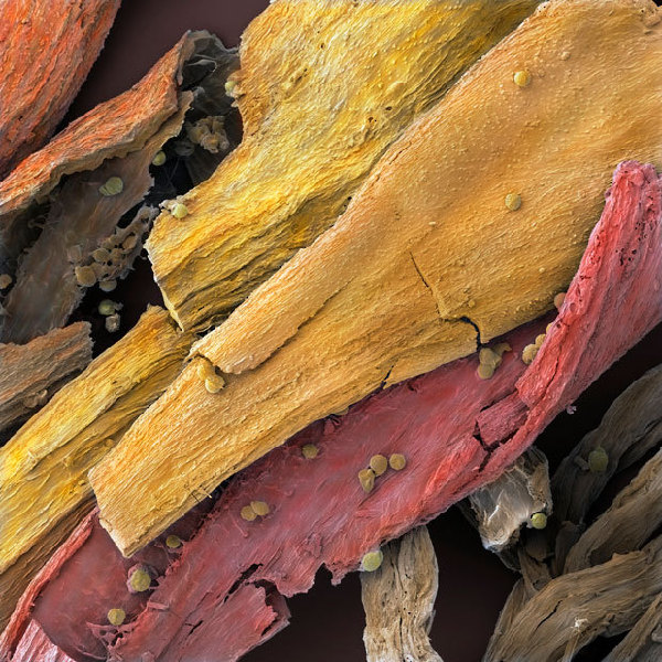 显微镜下食物惊人细节：西兰花似郁金香