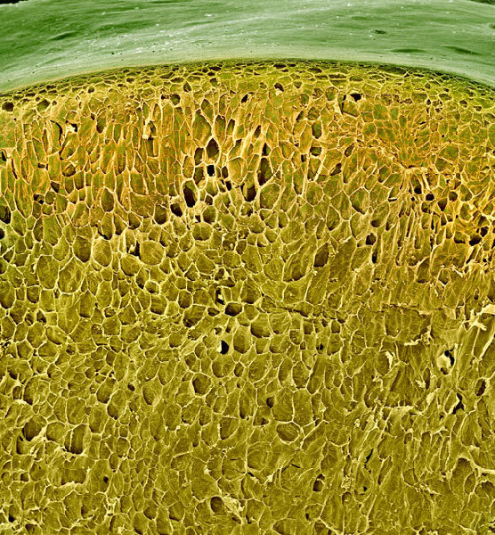 显微镜下食物惊人细节：西兰花似郁金香